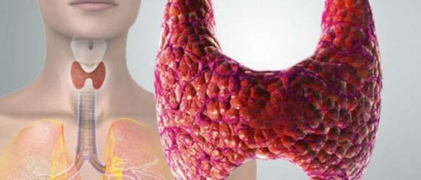 Щитовидка и суставы